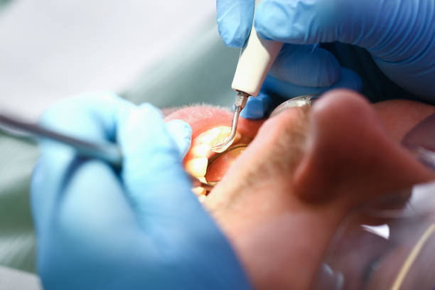 Best Walk-In Emergency Dentist in Zebulon, GA